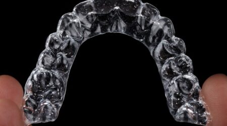 The Differences Between Braces and Invisalign in Dubai