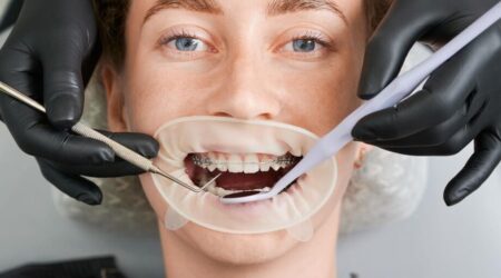 What Services Does a Dubai orthodontist Offer?