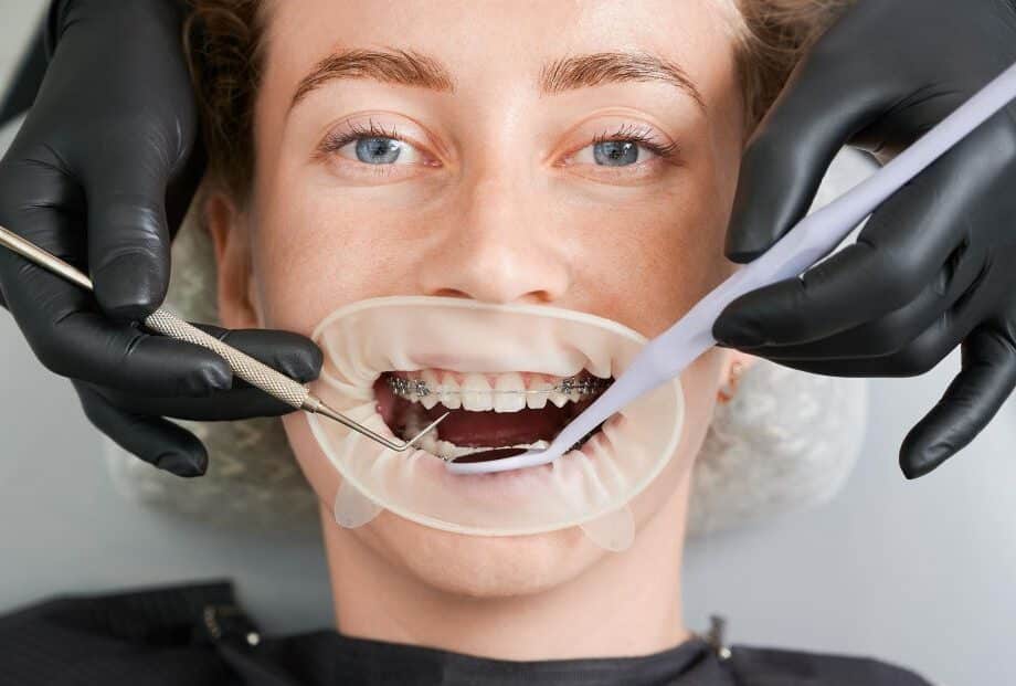 You are currently viewing What Services Does a Dubai orthodontist Offer?