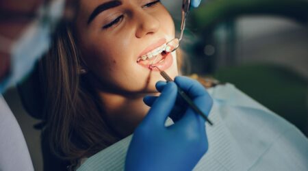 Braces Dubai | How Do I Choose the Right Type of Braces for Me?