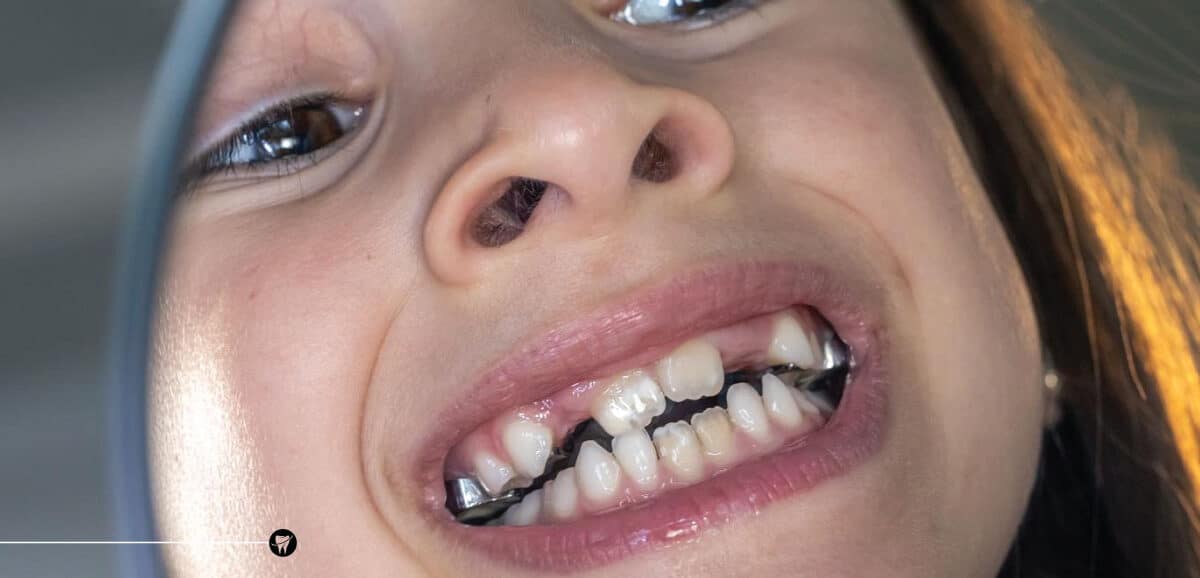 Early Intervention for Lifelong Smiles: Dr. Basel Mofti's Expert Orthodontic Care