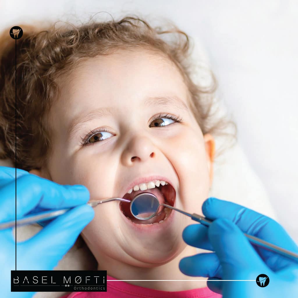 Early Intervention Dental Care in Dubai