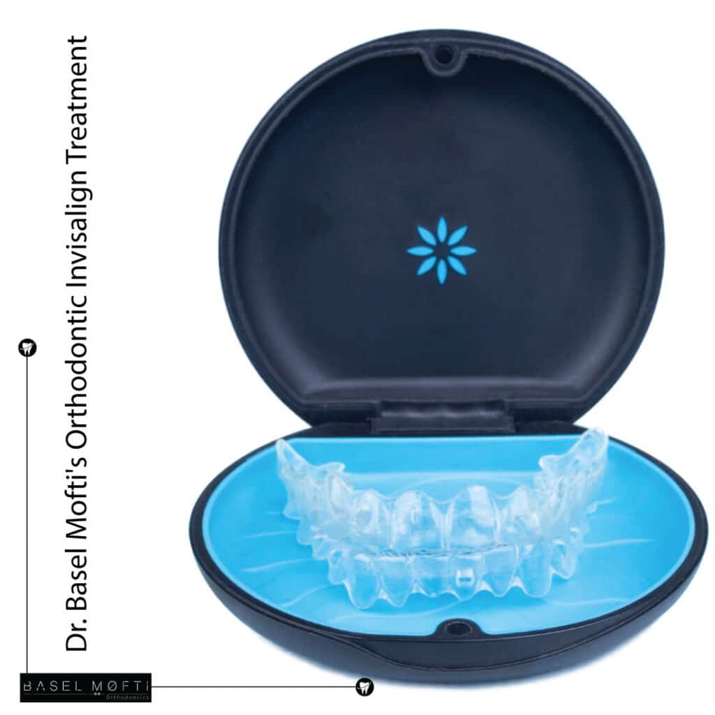 Dr. Basel Mofti's Orthodontic Invisalign Treatment Dubai