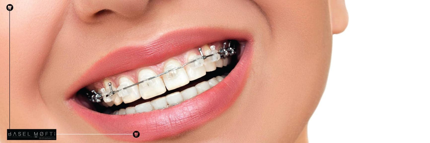 Dr.Basel Mofti Best Orthodontist in Dubai