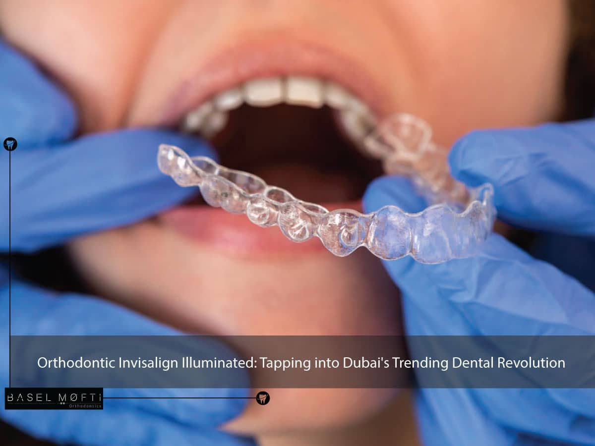 The Rise of Invisalign in Dubai